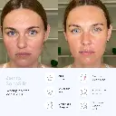 Zemits_SonoSilk2.jpg.webp